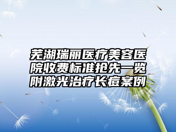 芜湖瑞丽医疗美容医院收费标准抢先一览附激光治疗长痘案例