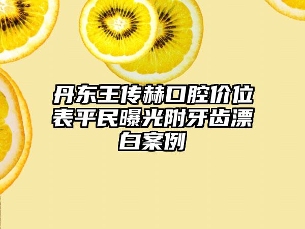 丹东王传赫口腔价位表平民曝光附牙齿漂白案例