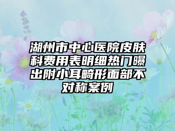 湖州市中心医院皮肤科费用表明细热门曝出附小耳畸形面部不对称案例