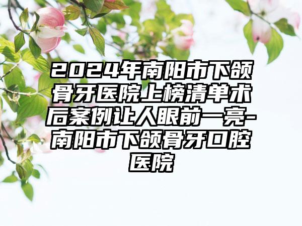 2024年南阳市下颌骨牙医院上榜清单术后案例让人眼前一亮-南阳市下颌骨牙口腔医院