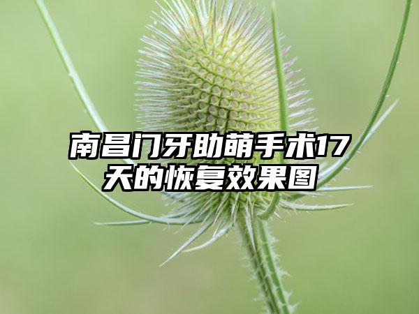 南昌门牙助萌手术17天的恢复效果图