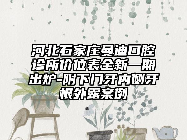 河北石家庄曼迪口腔诊所价位表全新一期出炉-附下门牙内侧牙根外露案例