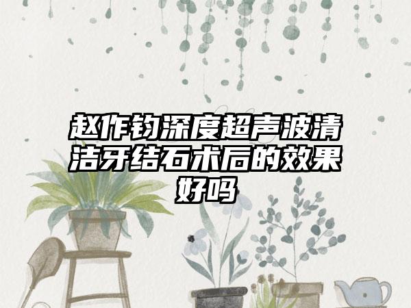 赵作钧深度超声波清洁牙结石术后的效果好吗